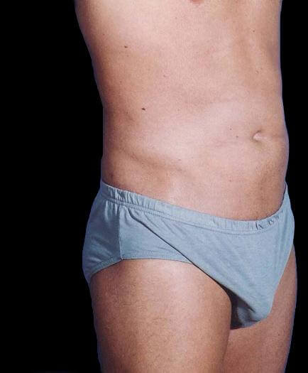 Male Liposuction After