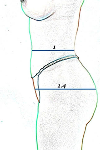 Brazilizn butt lift diagram